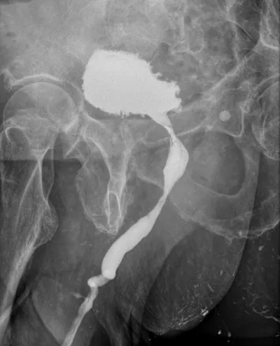 Cystographie