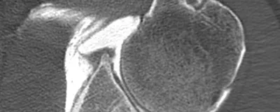 Arthro Scanner